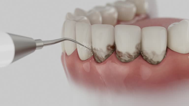 Trusted Tooth Extraction service in Ventnor City, NJ - Dentist Open Now